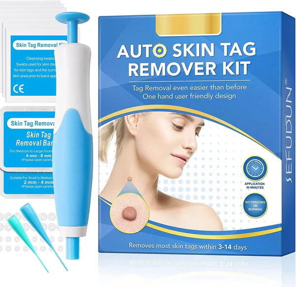 Leverfläcksborttagning - borttagning av födelsemärke